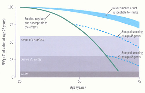 Time-course of chronic obstructive pulmonary disease (COPD)